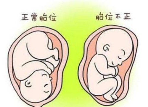 天津代怀生男孩：﻿详述试管宝宝易早产的原因